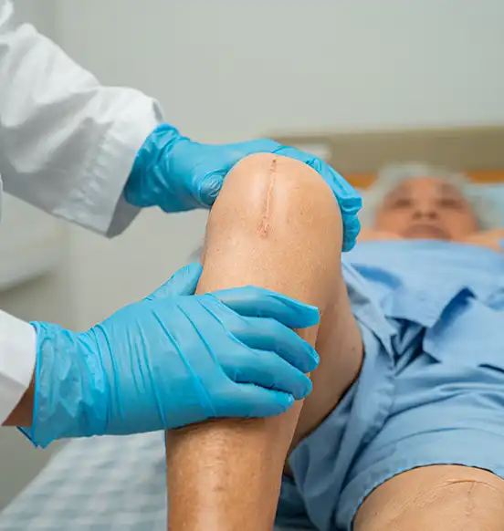 Knee